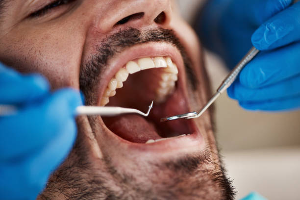 Dentist for Dental Trauma in MN